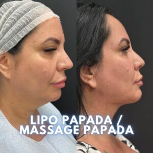 Body treatment