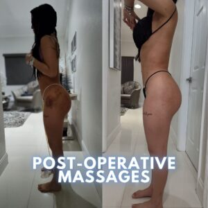 Post op care